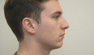side profile recessed chin male