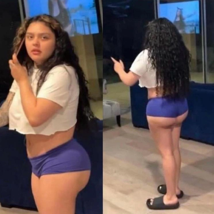 jaidyn bbl surgery