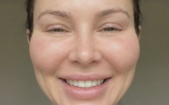 woman smiling excessive cheek filler pillow face effect