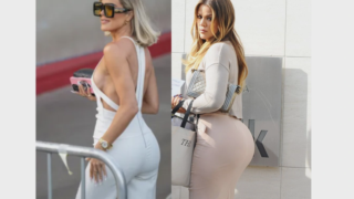 Khloé Kardashian's BBL Surgery (Old/New): Before and After