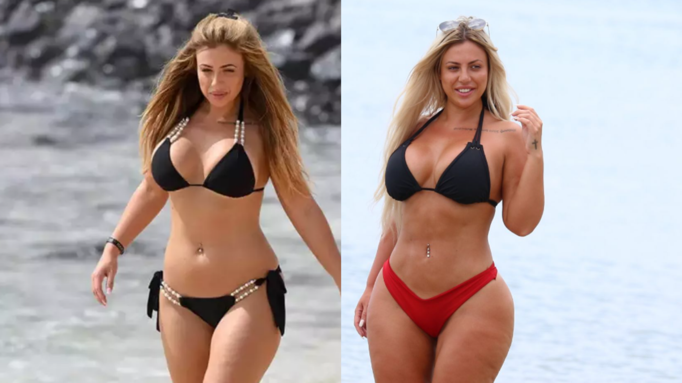 Chirurgia de lifting a feselor braziliană a lui Holly Hagan