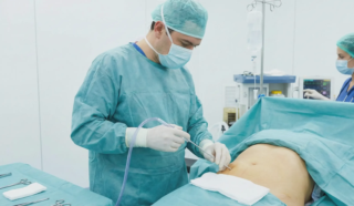 liposuction surgery procedure operating room
