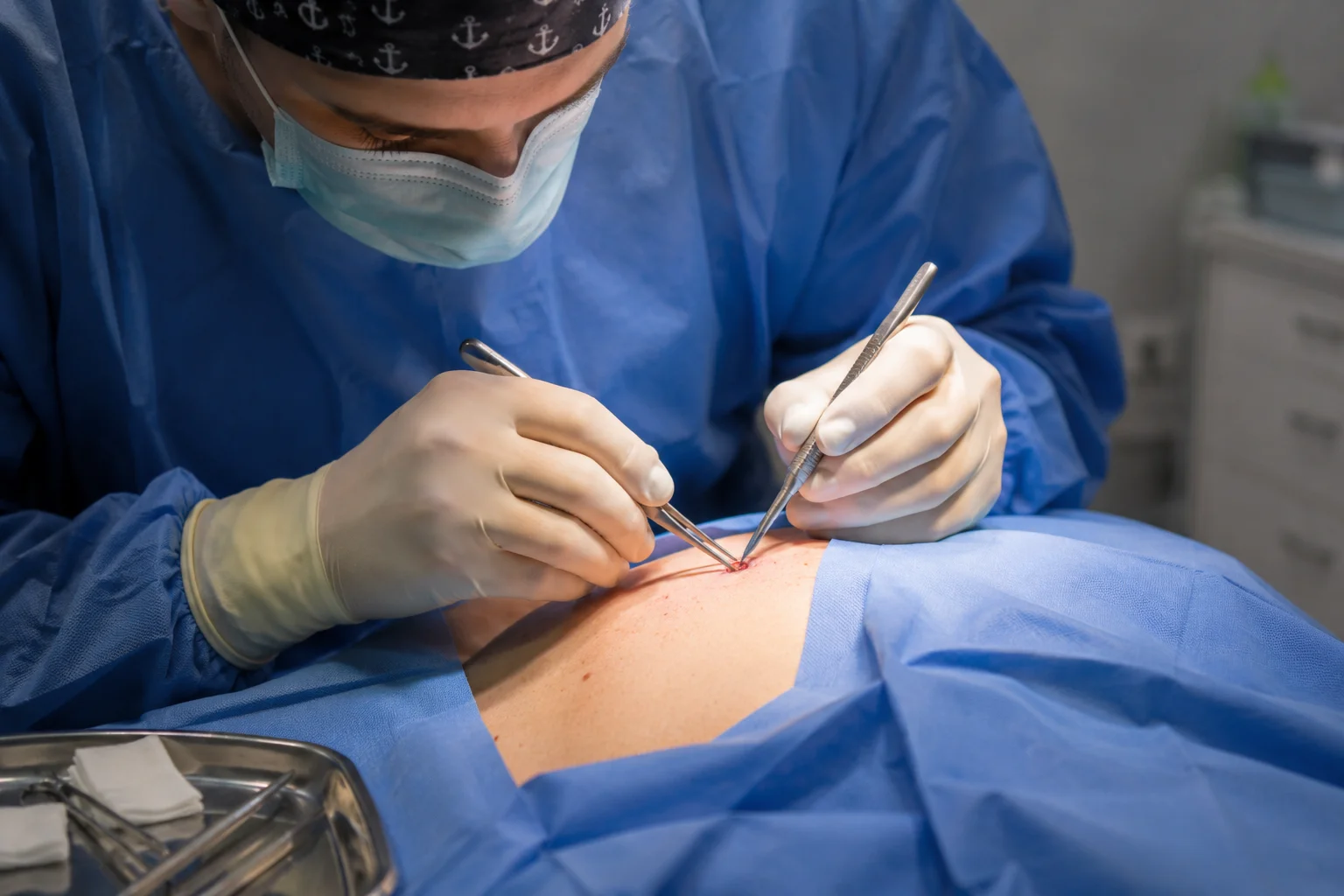 mole removal surgery