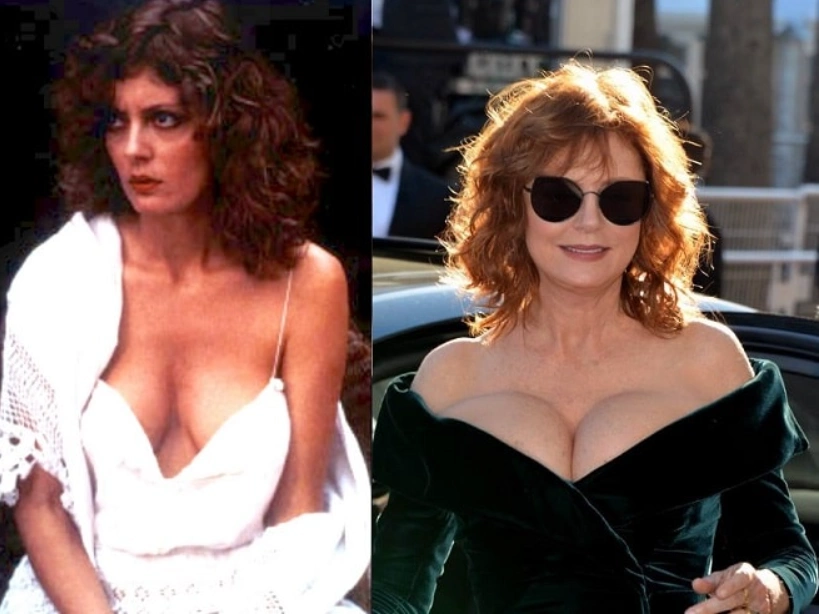 susan sarandon before after
