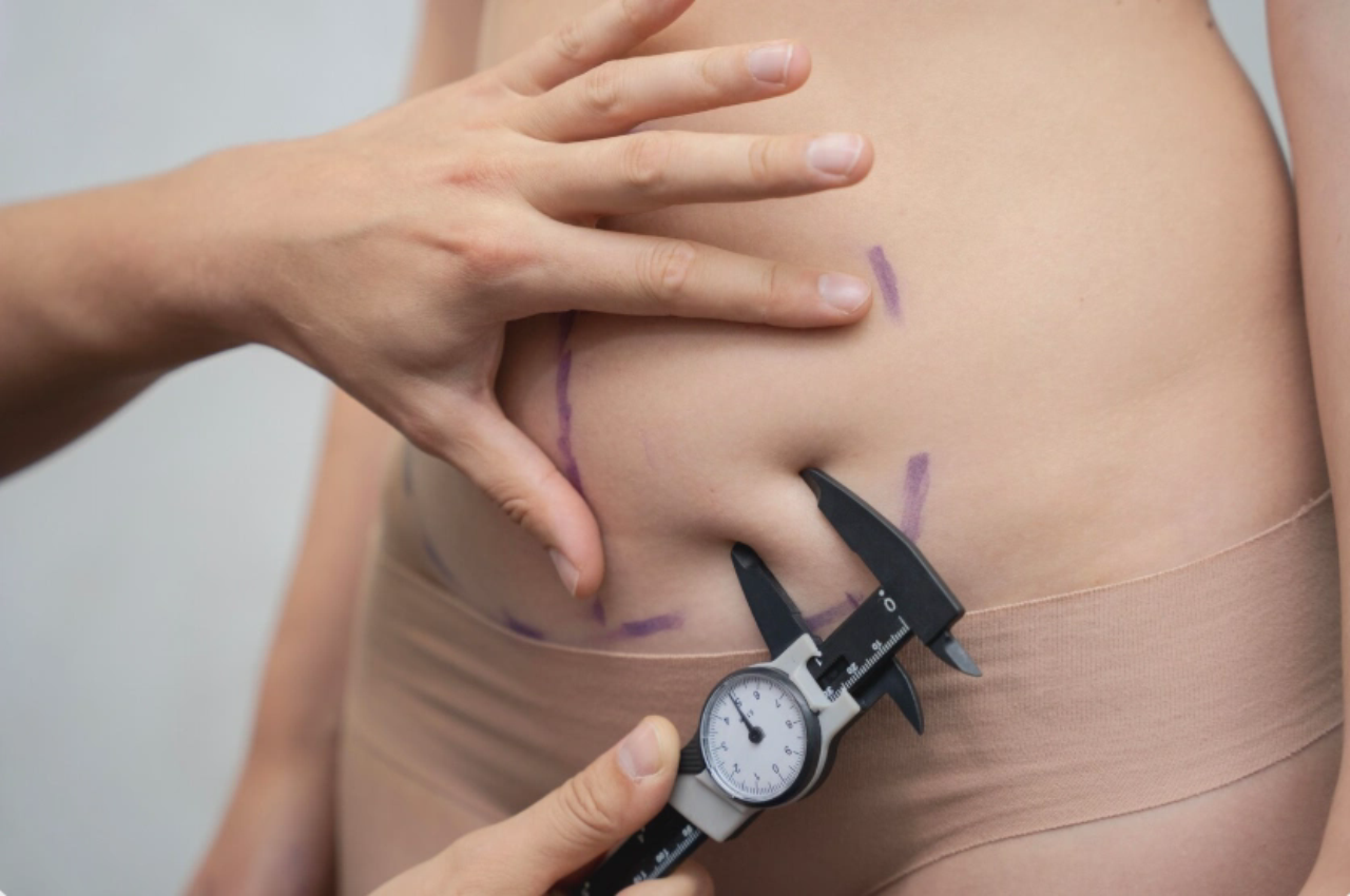 loose skin removal surgery