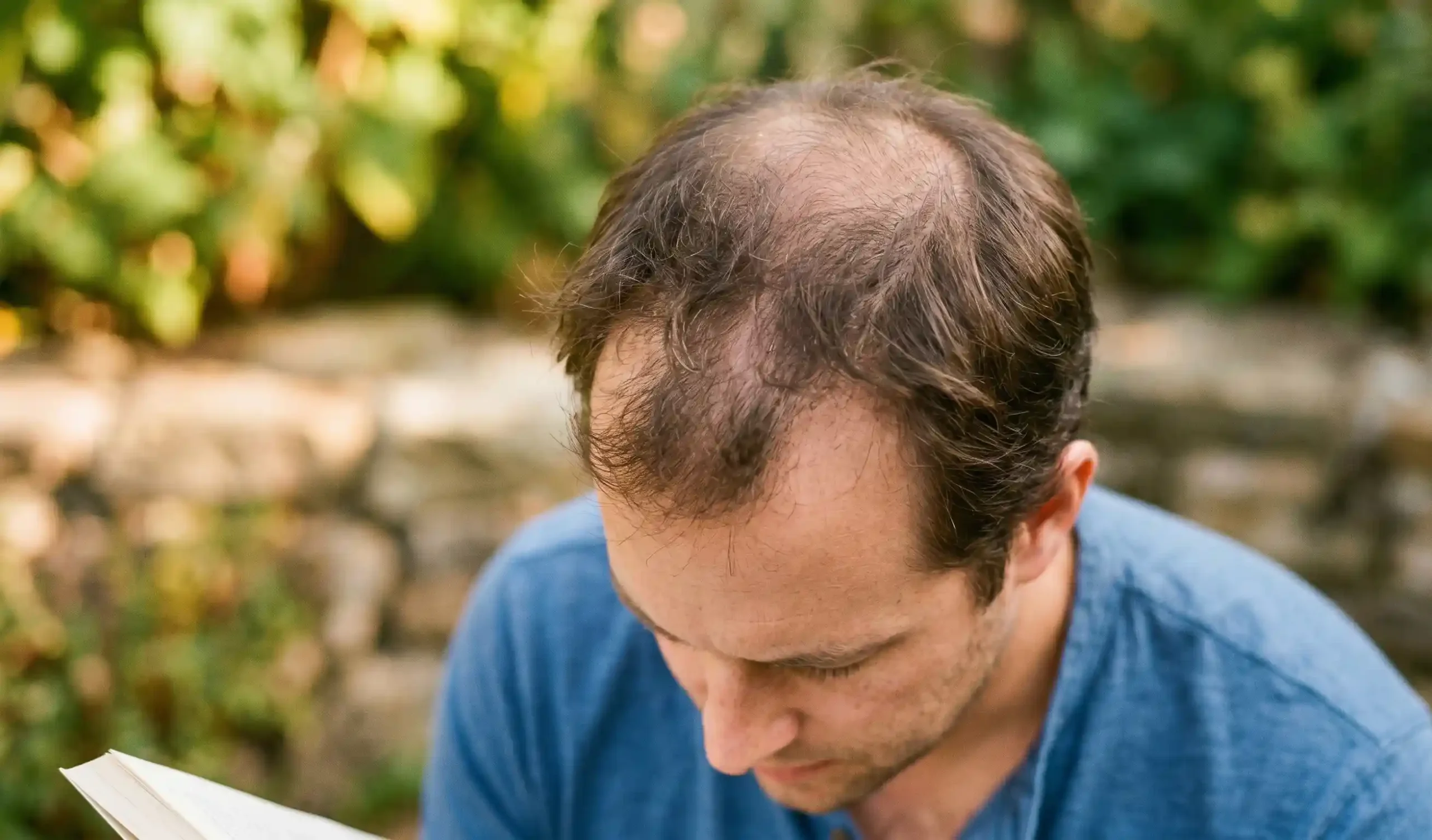 natural candid hair loss