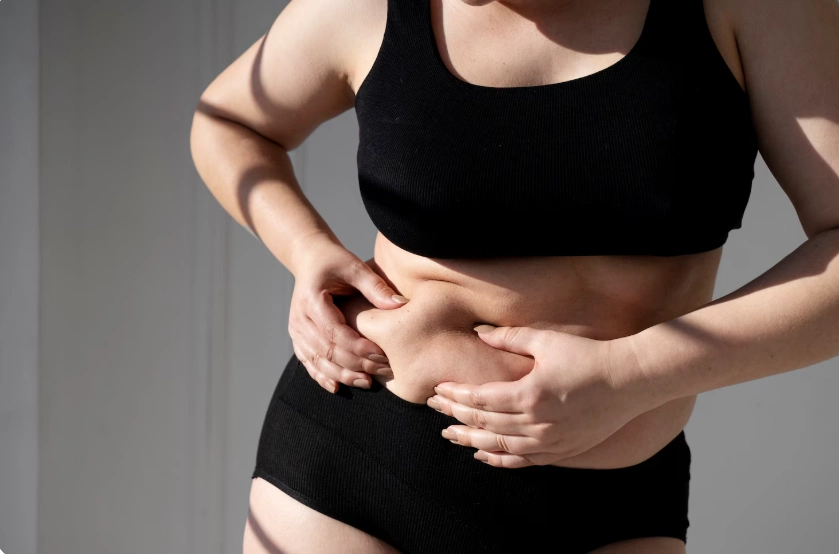 belly fat removal surgery