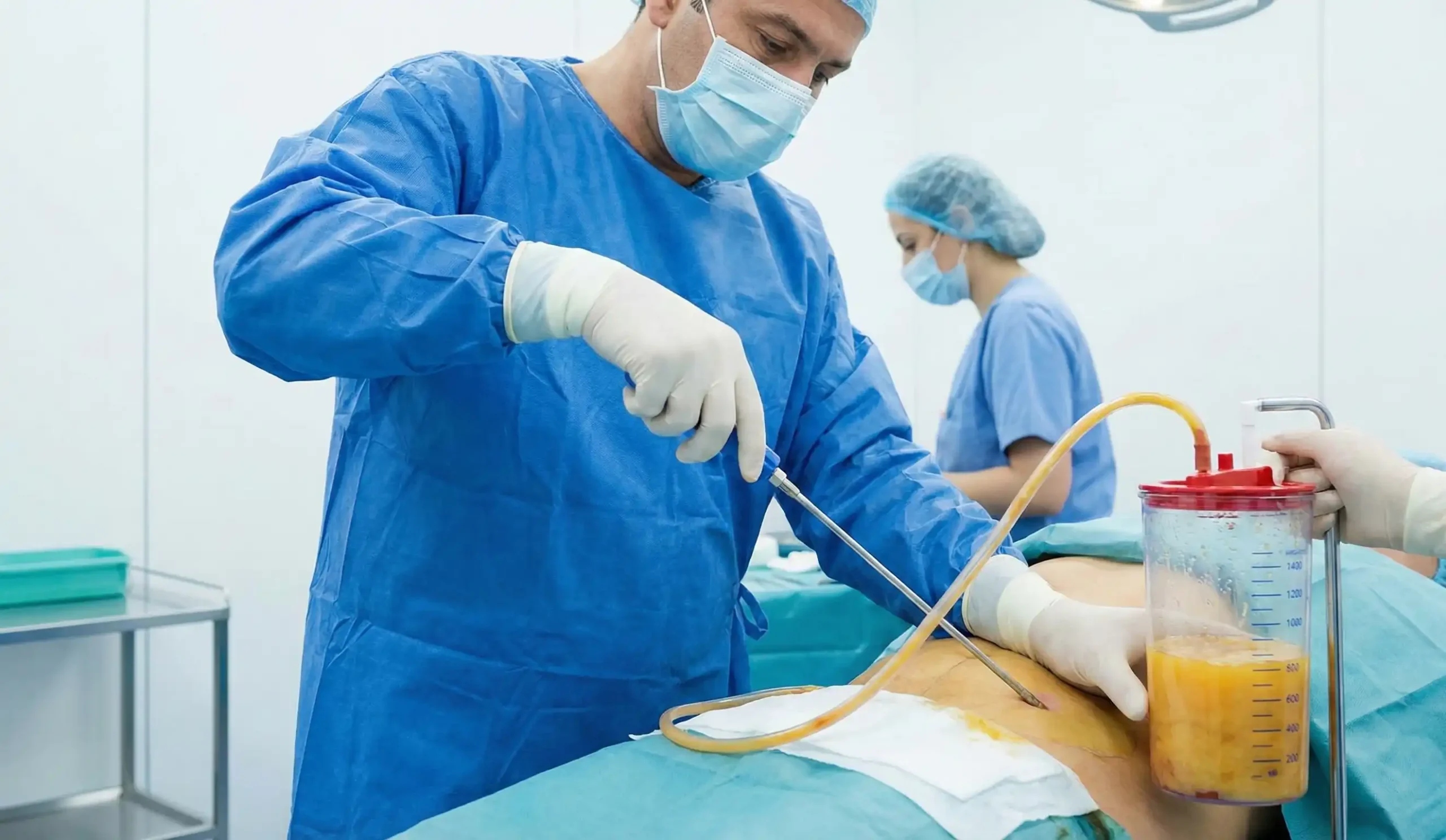 surgeon harvesting fat cells via liposuction for transfer