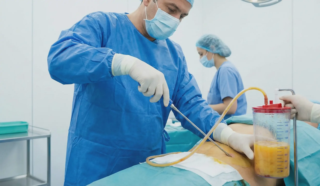 surgeon harvesting fat cells via liposuction for transfer