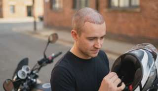 patient motorcycle helmet post hair transplant examination