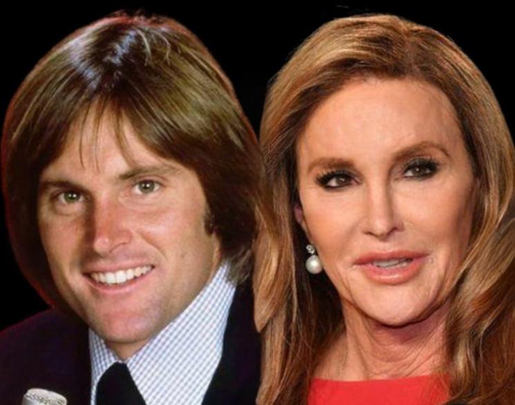 caitlyn jenner before after