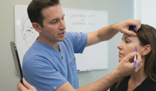surgeon marking lateral cheek lift vector
