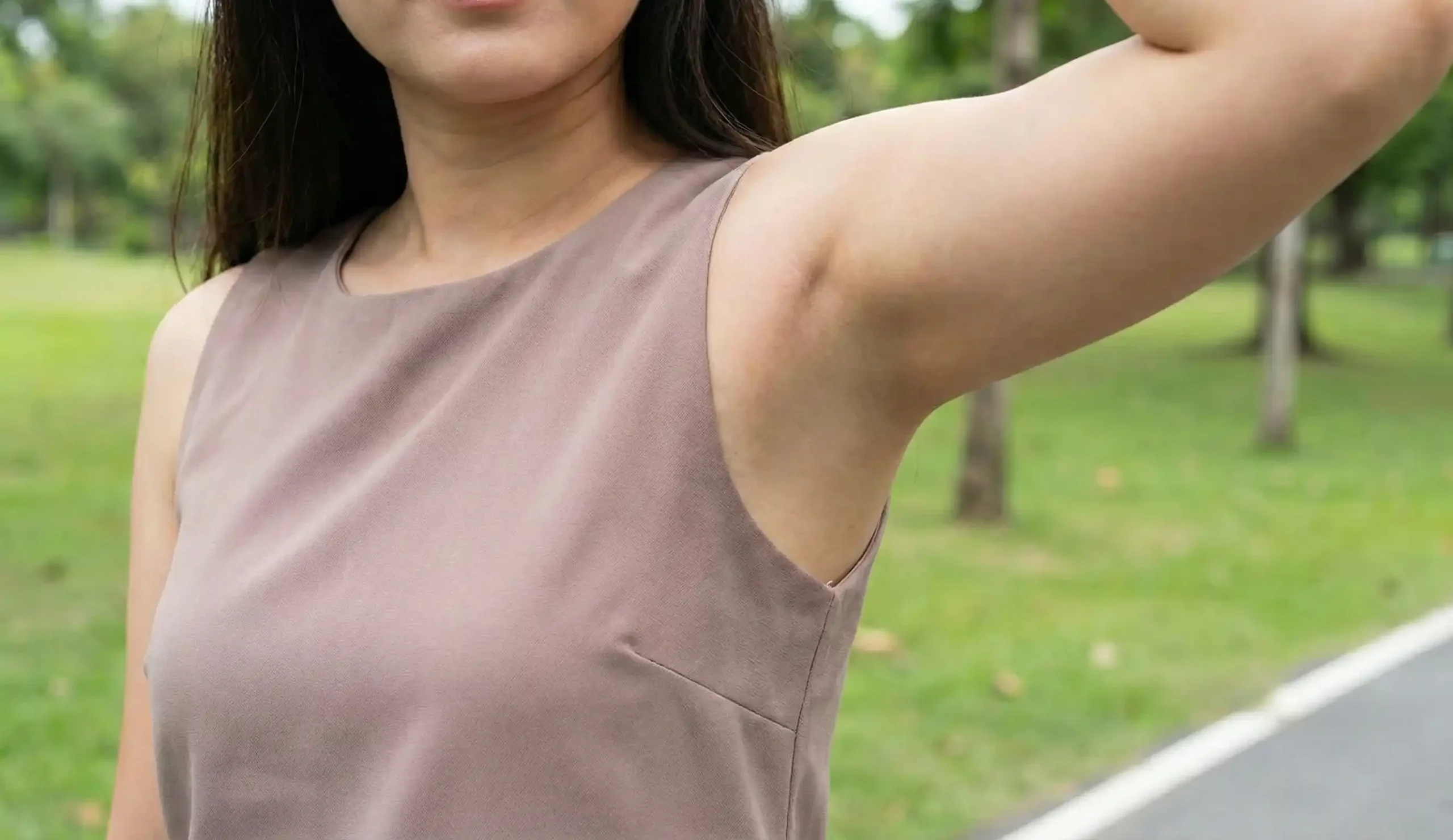 woman with smooth underarm contour after axillary liposuction