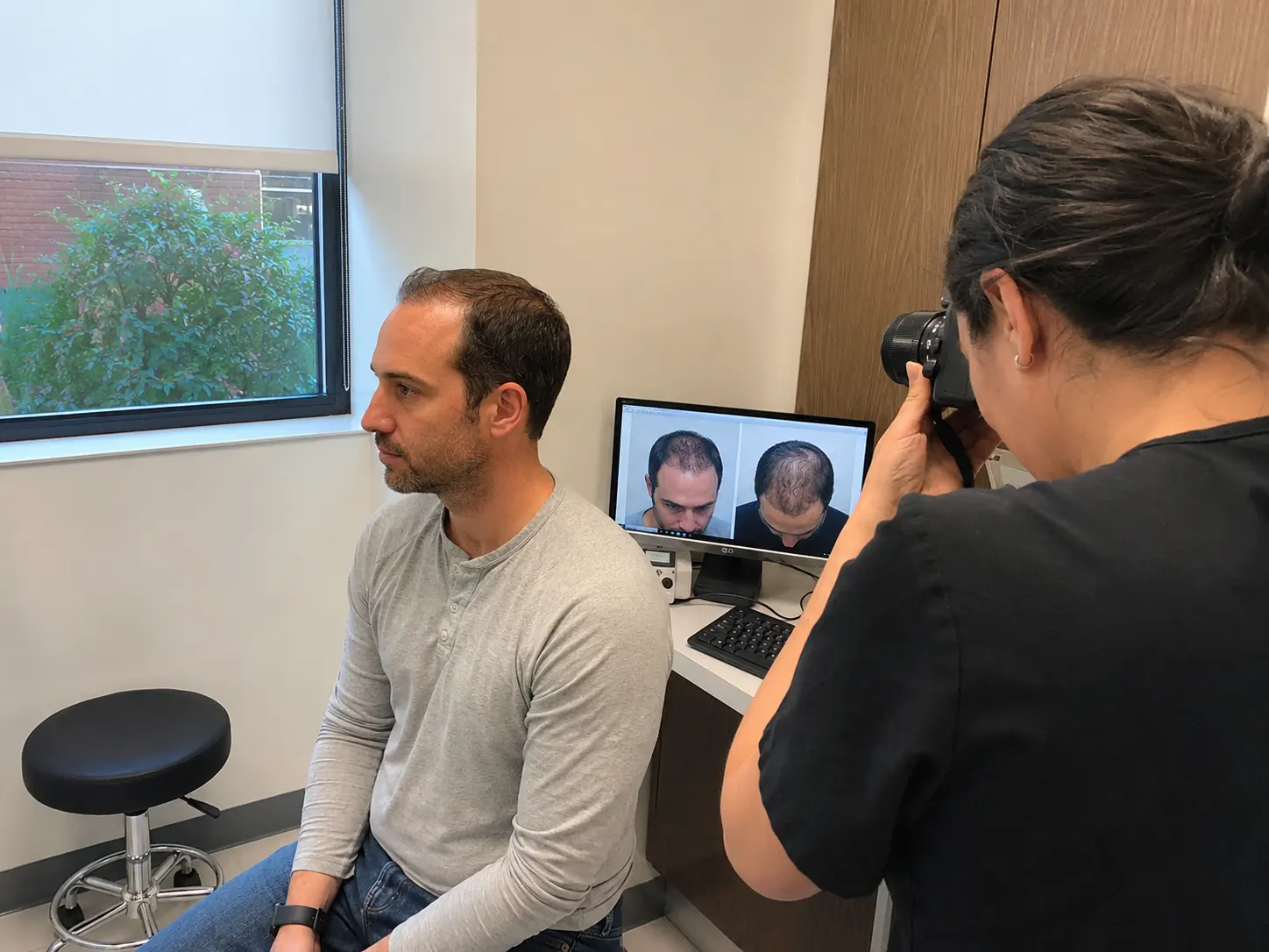 hair transplant progress photo session