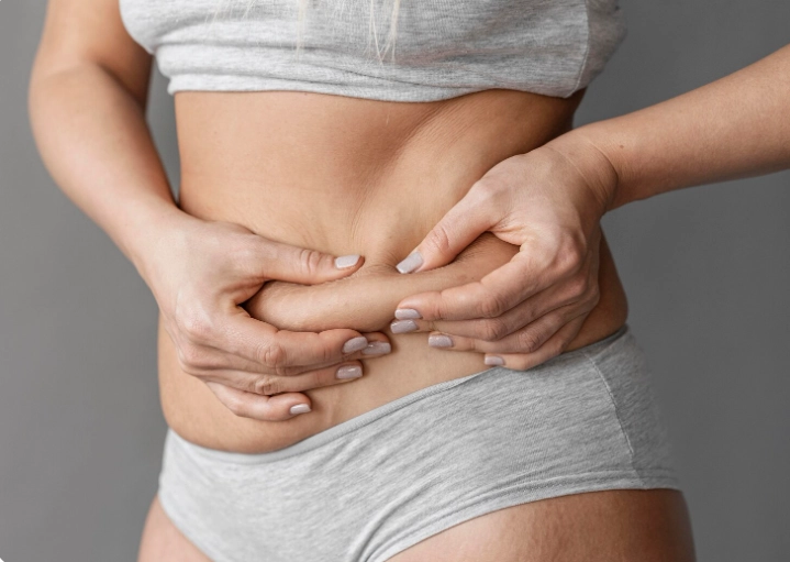 Does Liposuction Get Rid of Cellulite? Facts & Results