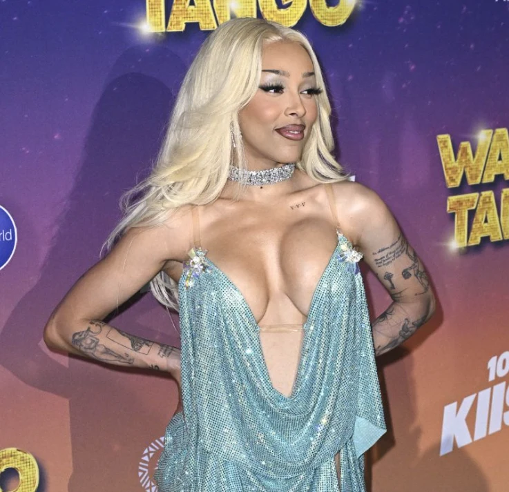 doja cat after the surgery