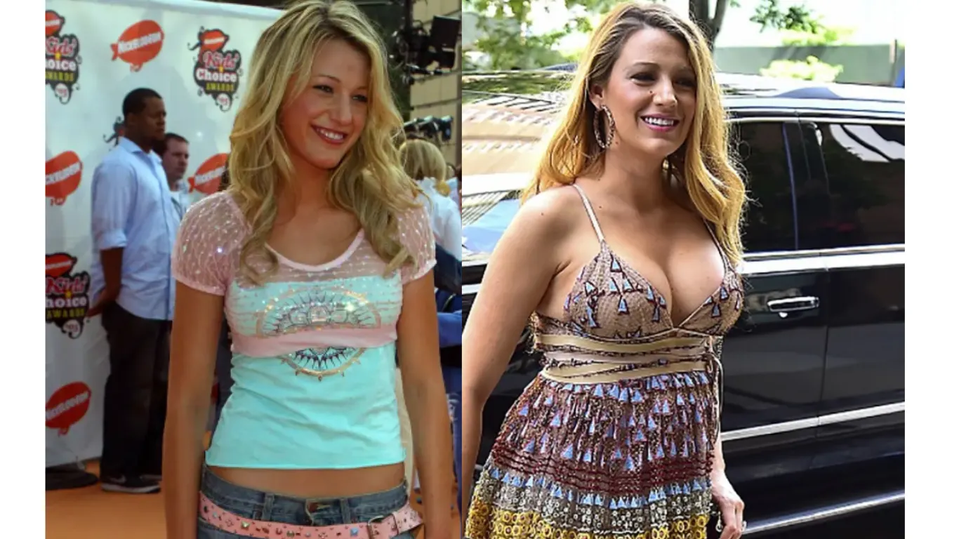 blake lively breast implants before after cover