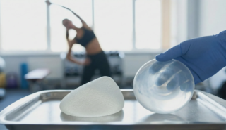 implants for active lifestyle comparison