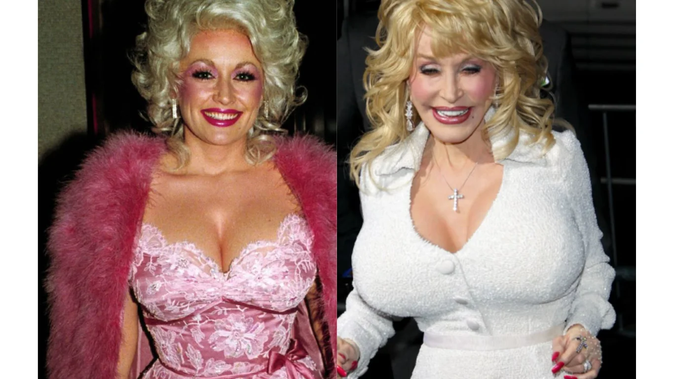 doly patron before after cover