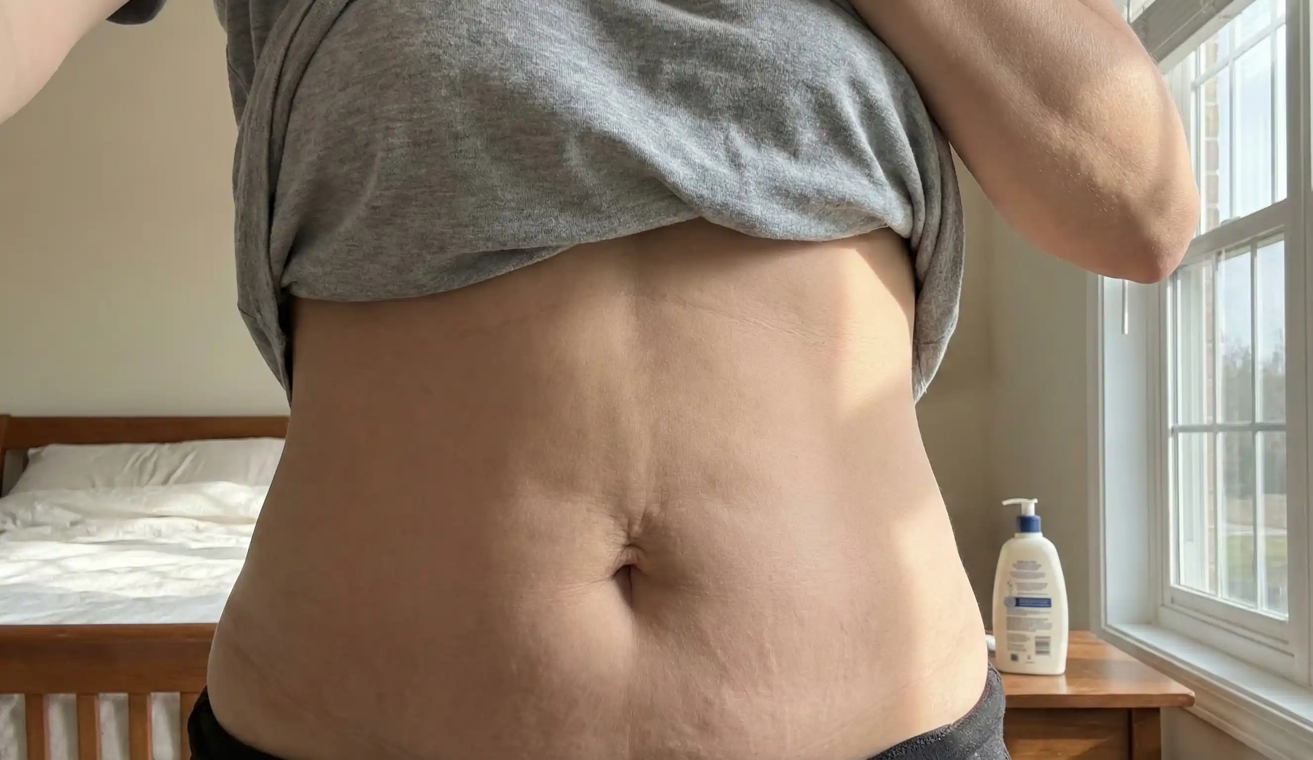 skin elasticity aging after lipo