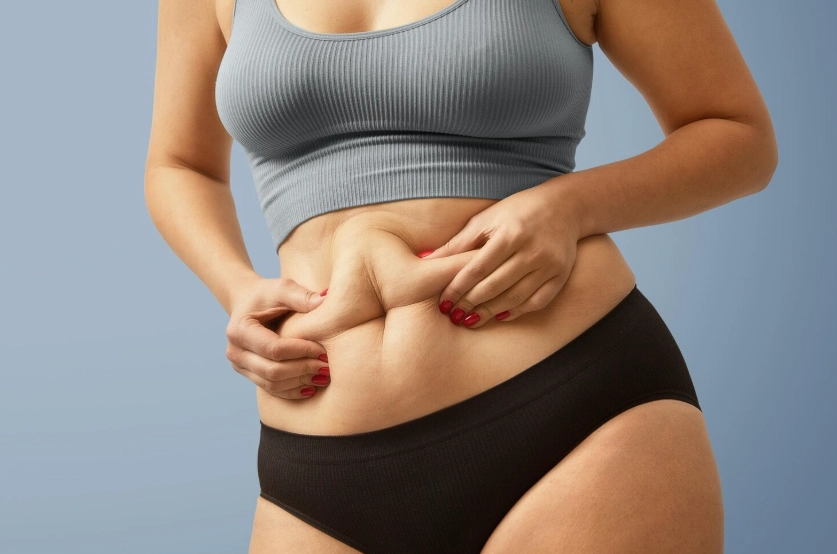 belly fat removal