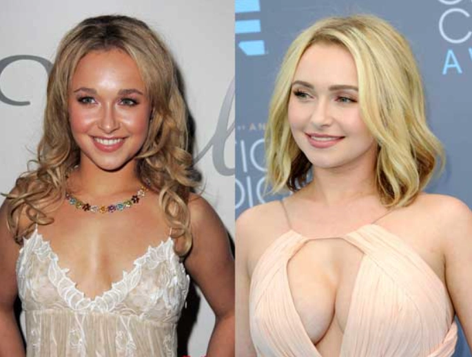 hayden panettiere before and after