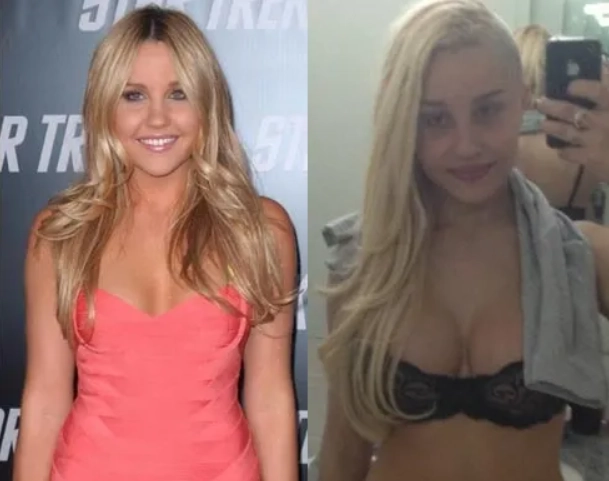 amanda bynes before and after cover