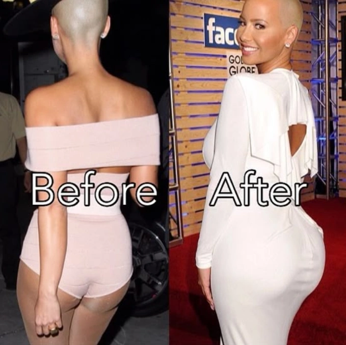Chirurgia BBL a lui Amber Rose: Înainte și După