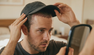 hair transplant hat sweat damage