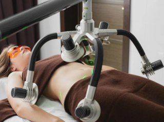 Liposuzione Laser: Procedura Efficace di Rimozione del Grasso