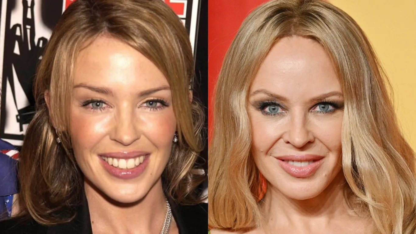 kylie minogue before after cover
