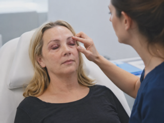 eyelid surgery swelling