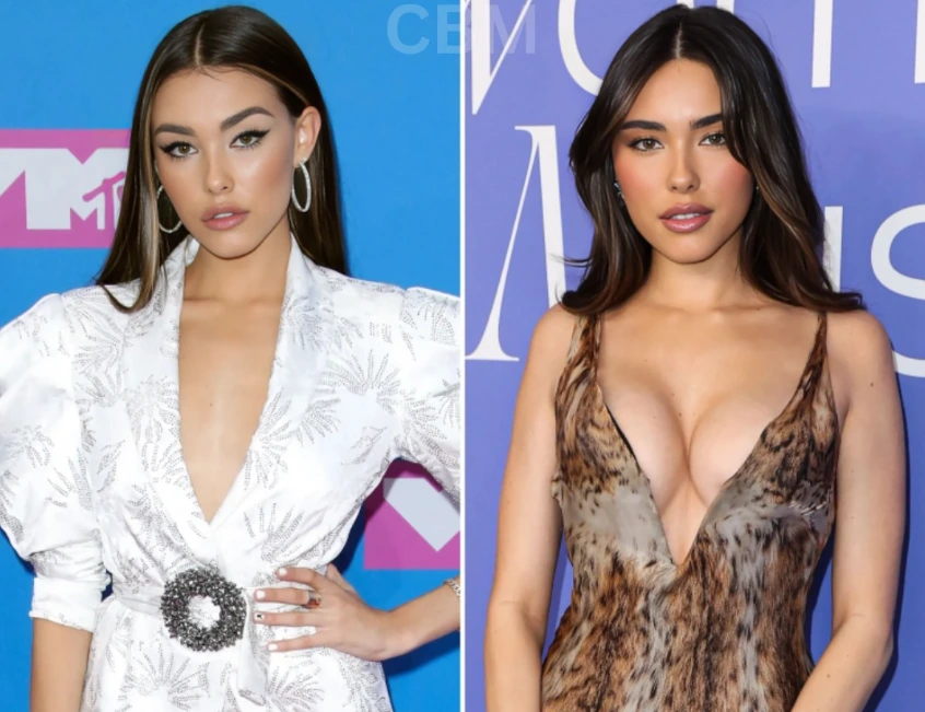 madison before after photos
