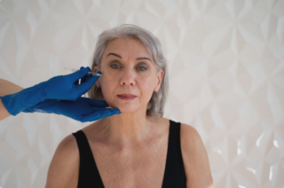botox for bunny lines