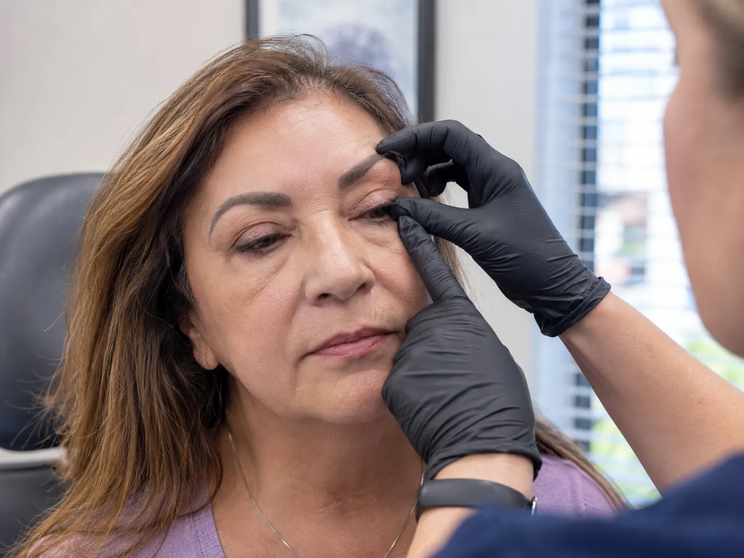 eyelash retention after blepharoplasty exam