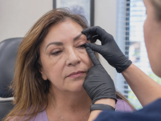 eyelash retention after blepharoplasty exam