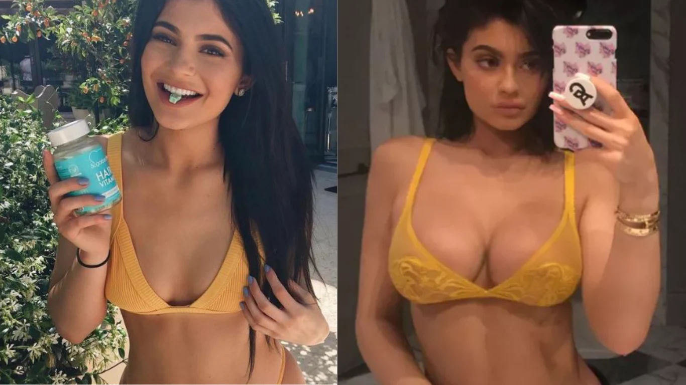 kylie jenner before after cover