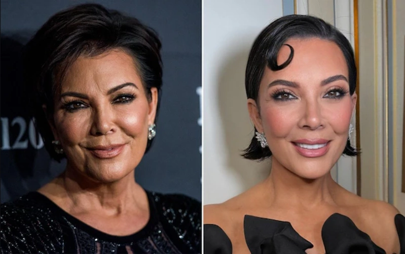 kris jenner face lift