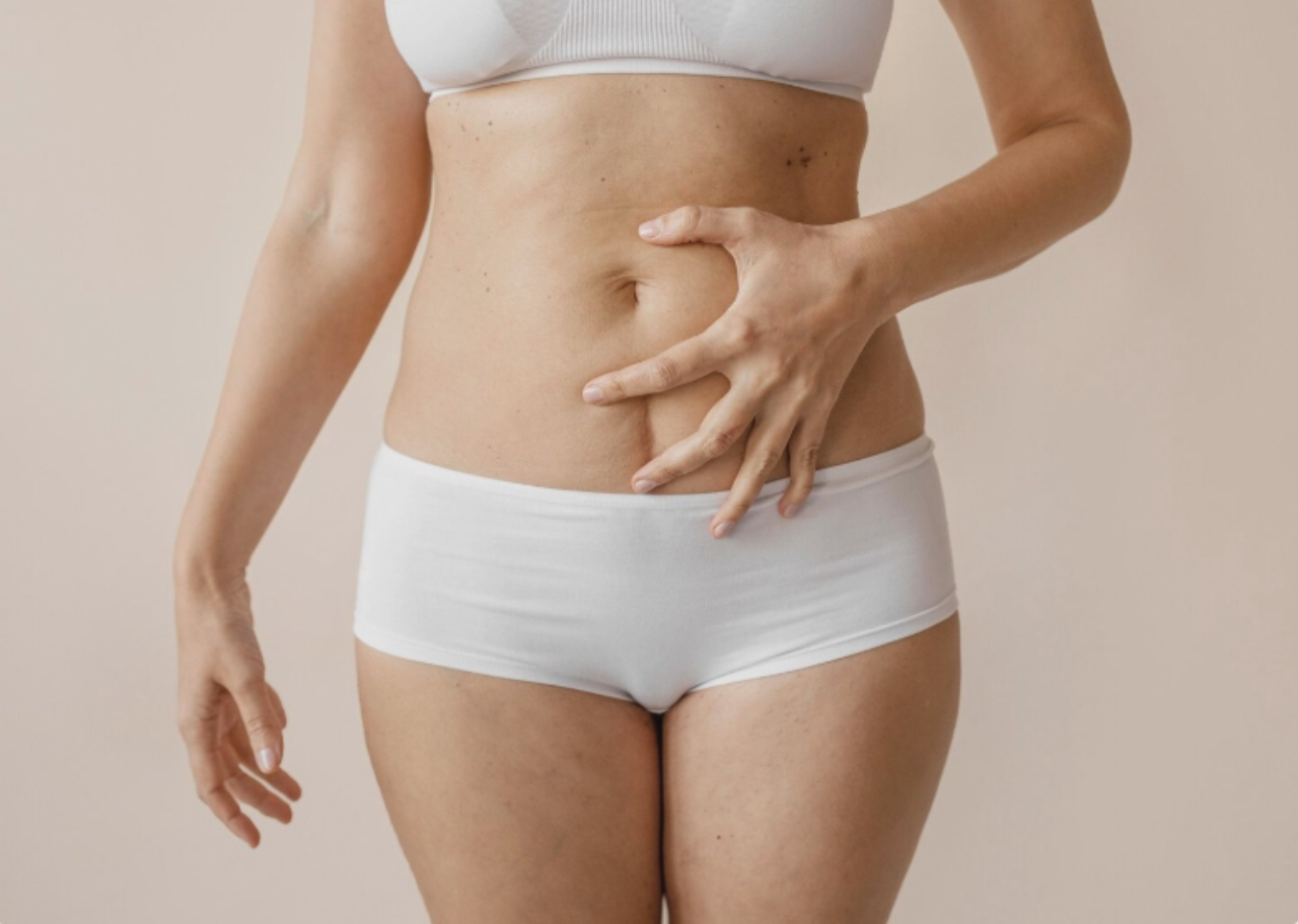 Liposuction Scars: Aftercare and Recovery