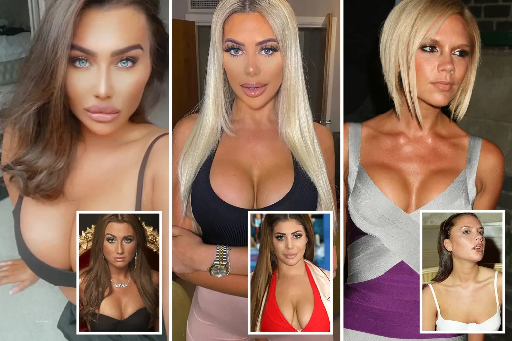 celebrities with implants