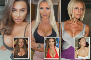 celebrities with implants