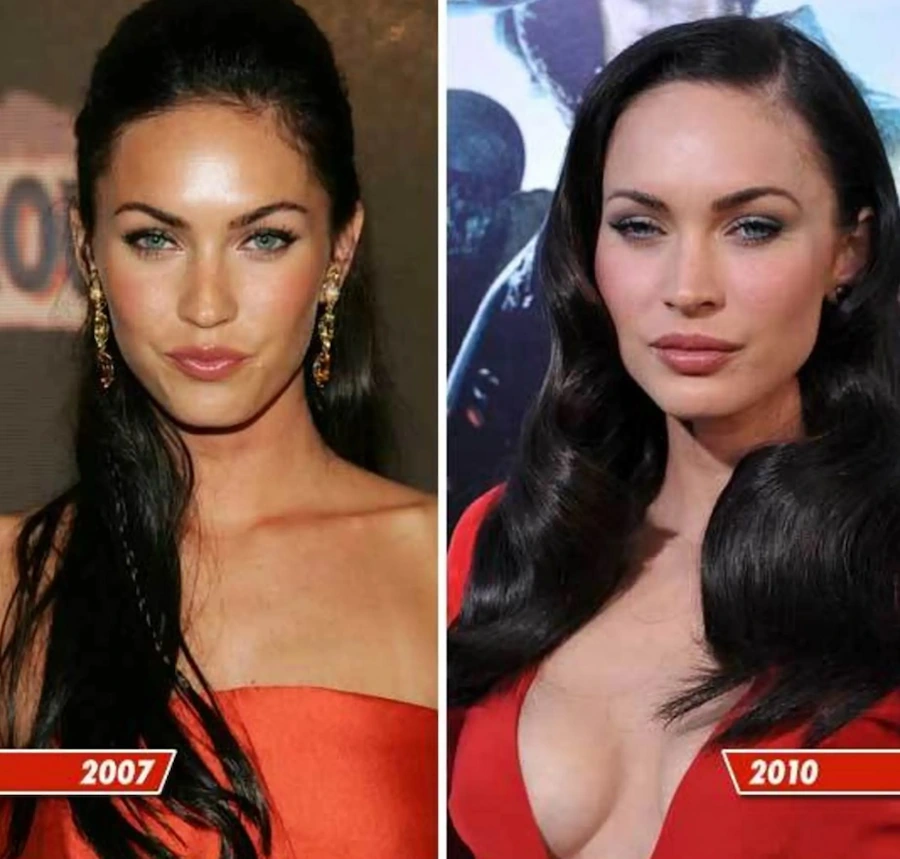 Implanturile mamare ale lui Megan Fox (Vechi / Nou): Înainte și după