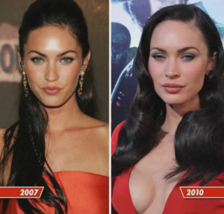 Megan Fox's Breast Implant (Old/New): Before and After!
