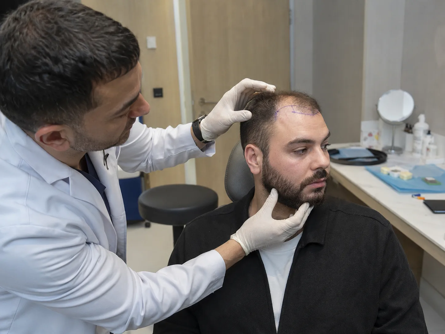 beard transplanted on the head