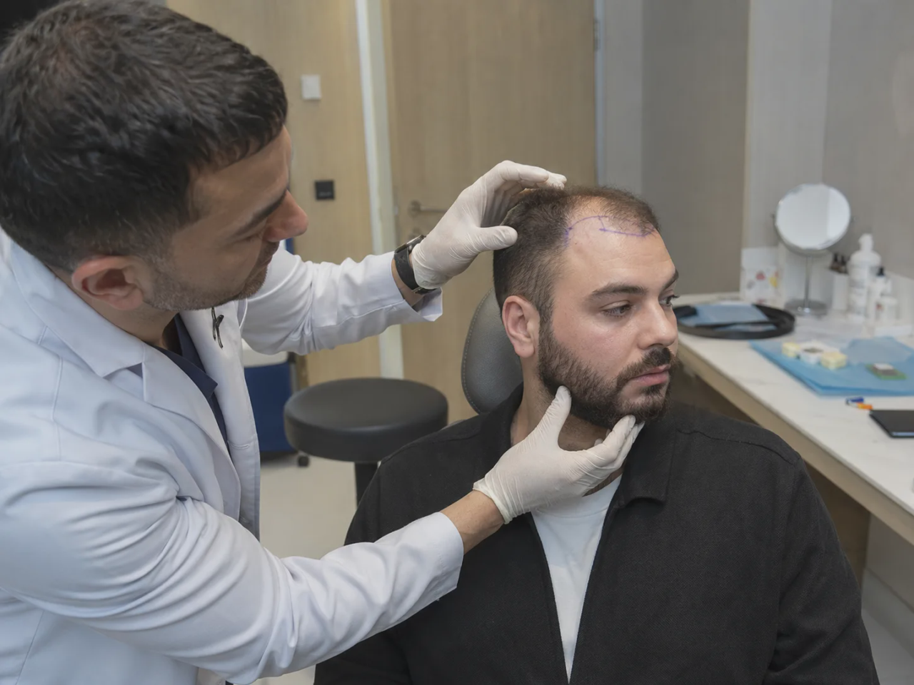 beard transplanted on the head