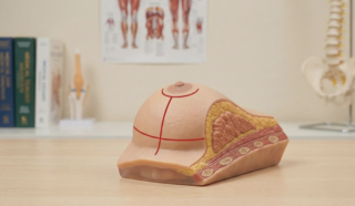 anatomical 3d model breast reduction t junction