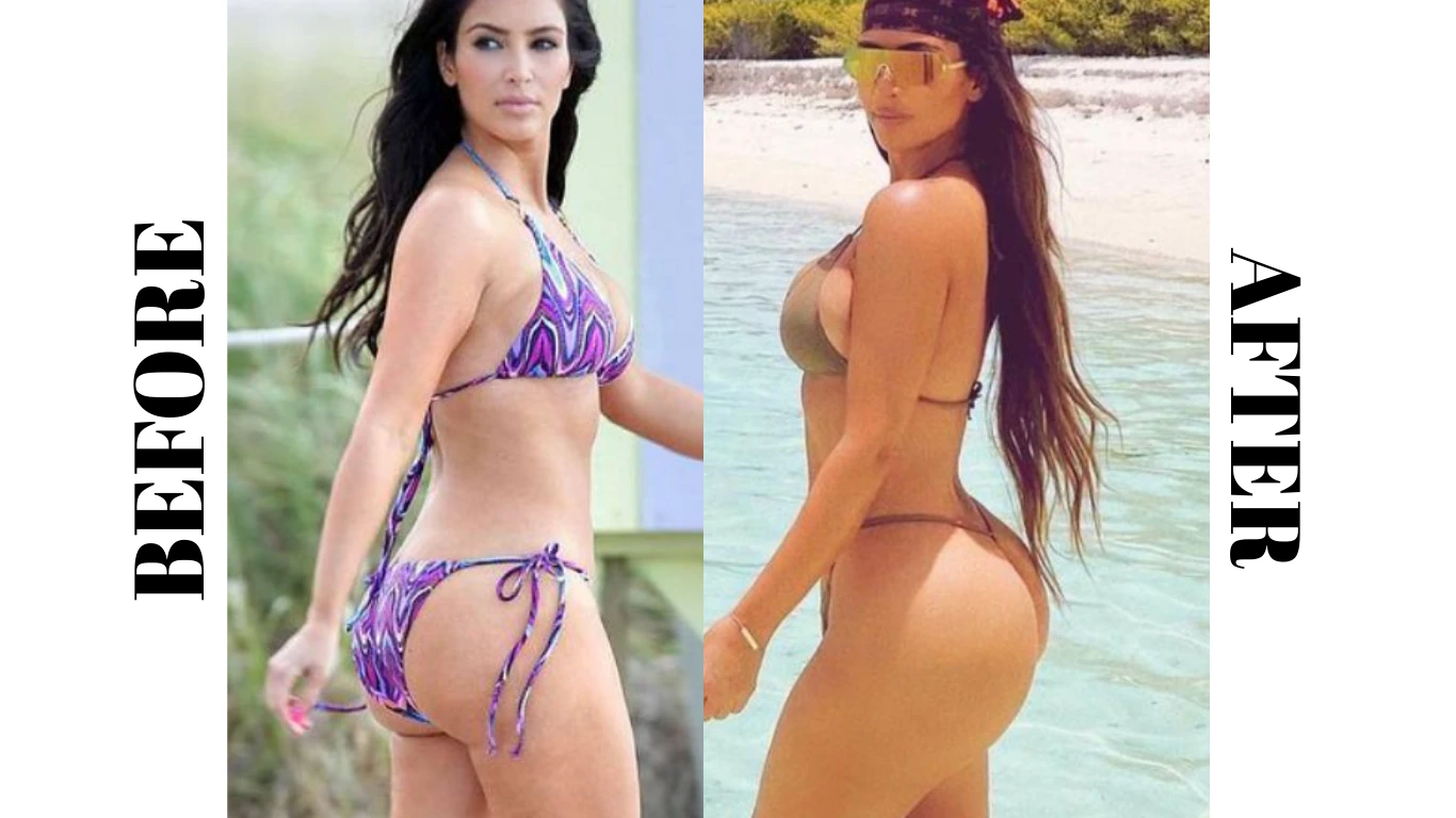 Transformarea BBL a lui Kim Kardashian: Înainte și după