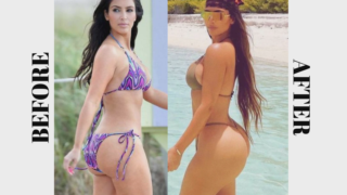 Kim Kardashian's BBL Transformation: Before and After