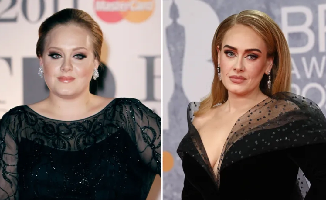 Adele’s Liposuction Transformation: Before and After