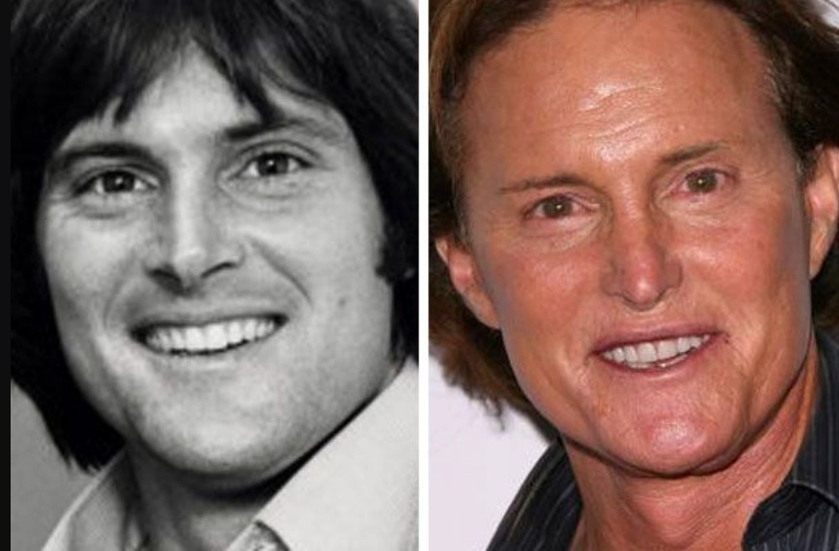 caitlyn jenner before after cover